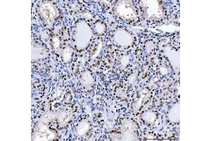 IHC analysis of MBNL1 using anti-MBNL1 antibody (ABIN7602608). (MBNL1 anticorps  (AA 89-388))