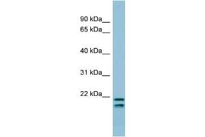 WB Suggested Anti-SFTPC Antibody Titration:  0.