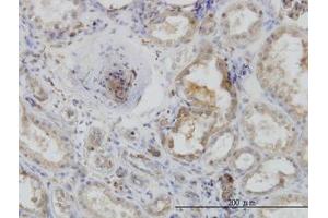 Image no. 4 for anti-Actin-Related Protein 2 (ACTR2) (AA 1-395) antibody (ABIN599116) (ACTR2 anticorps  (AA 1-395))