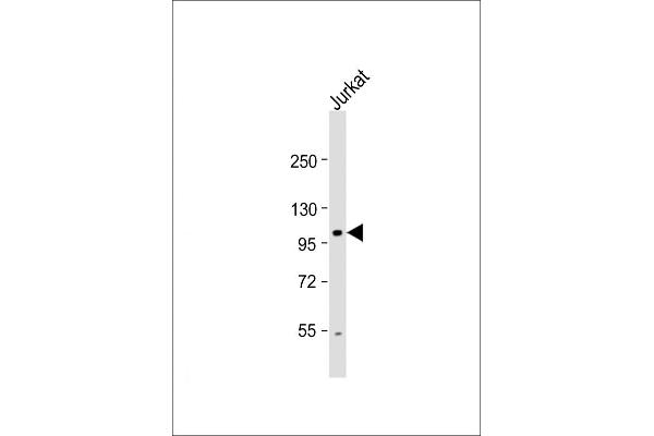 Unc5c antibody  (N-Term)