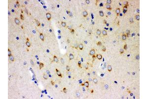 Anti- SSH3BP1 Picoband antibody, IHC(P) IHC(P): Rat Brain Tissue (ABI1 anticorps  (N-Term))