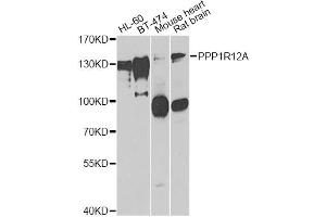 Western blot analysis of extracts of various cell lines, using PPP1R12A antibody. (PPP1R12A anticorps)