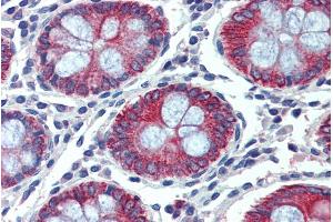 ABIN238594 (2. (EPB41L2 anticorps  (Internal Region))