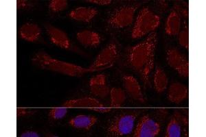 anti-Metaxin 1 (MTX1) antibody