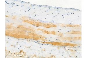 ABIN6256242 and ABIN6267094 at 1/100 staining Mouse skin tissue by IHC-P.