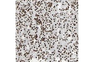 Immunohistochemical staining of human pancreas with CCAR1 polyclonal antibody  shows strong nuclear positivity in exocrine glandular cells. (CCAR1 anticorps)