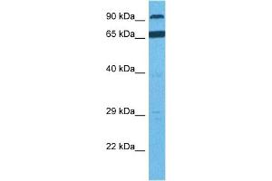 Host:  Rabbit  Target Name:  RHBDF1  Sample Tissue:  Human PANC1 Whole Cell  Antibody Dilution:  1ug/ml (RHBDF1 anticorps  (N-Term))