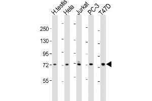All lanes : Anti-TNK1 Antibody (C-term) at 1:1000-1:2000 dilution Lane 1: human testis lysates Lane 2: Hela whole cell lysates Lane 3: Jurkat whole cell lysates Lane 4: PC-3 whole cell lysates Lane 5: T47D whole cell lysates Lysates/proteins at 20 μg per lane. (TNK1 anticorps  (C-Term))