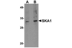 Western blot analysis of SKA1 in A549 cell lysate with SKA1 antibody at 0. (SKA1 anticorps  (C-Term))