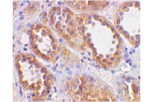 Immunohistochemical staining of human kidney cellsusing ACE2 polyclonal antibody  at 2 ug/mL . (ACE2 anticorps  (N-Term))