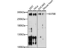 Western blot analysis of extracts of various cell lines, using KB antibody (ABIN7268062) at 1:1000 dilution. (KAT6B anticorps  (AA 400-500))