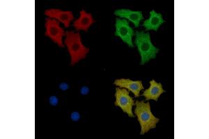 Laminin 2 alpha Mouse Monoclonal Antibody staining HepG2 cells by IF/ICC. (Laminin anticorps  (N-Term))