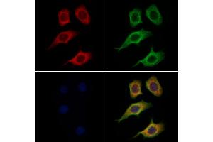 ABIN6265828 and ABIN6269033 staining Hela cells by IF/ICC. (TYR anticorps  (C-Term))
