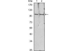 Western blot analysis using HDAC4 mouse mAb against Hela (1), Jurkat (2) cell lysate.