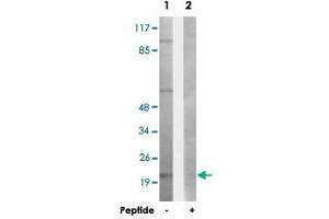Western blot analysis of extracts from HepG2 cells, using LTB polyclonal antibody . (LTB anticorps  (C-Term))