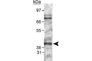 Western blot analysis of PHD2 in mouse kidney lysate using Egln1 polyclonal antibody . (EGLN1 anticorps  (AA 300-400))