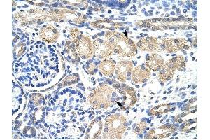 KCNAB2 antibody was used for immunohistochemistry at a concentration of 4-8 ug/ml to stain EpitheliaI cells of renal tubule (arrows) in Human Kidney.