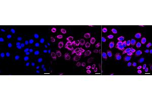 Immunocytochemical staining of HepG2 cells with Glutaminase antibody (ABIN7798747), 1:1,000).
