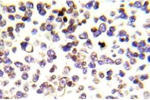 Immunohistochemistry (IHC) analyzes of Histone H2A. (H2AFX anticorps)