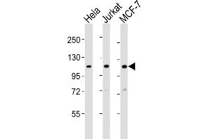 All lanes : Anti-EXOC4 Antibody (N-term) at 1:2000 dilution Lane 1: Hela whole cell lysates Lane 2: Jurkat whole cell lysates Lane 3: MCF-7 whole cell lysates Lysates/proteins at 20 μg per lane.