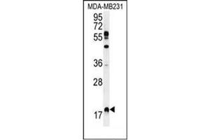 Western blot analysis of RHEB Antibody (C-term) in MDA-MB231 cell line lysates (35ug/lane). (RHEB anticorps  (C-Term))