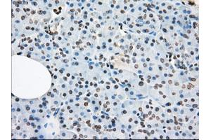 Immunohistochemical staining of paraffin-embedded colon tissue using anti-XRCC4mouse monoclonal antibody. (LTA4H anticorps)