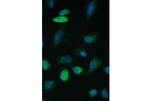 IF analysis of TIMM17A using anti-TIMM17A antibody (ABIN6719637).