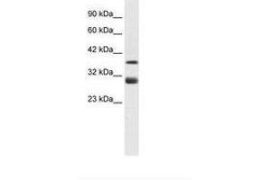 Image no. 2 for anti-T-Cell Acute Lymphocytic Leukemia 1 (TAL1) (AA 236-285) antibody (ABIN6735910) (TAL1 anticorps  (AA 236-285))