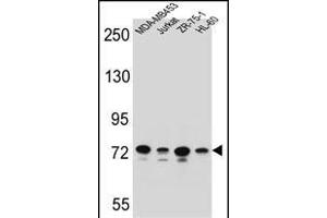 PCDHB15 Antibody (N-term) (ABIN655956 and ABIN2845342) western blot analysis in MDA-M,Jurkat,ZR-75-1,HL-60 cell line lysates (35 μg/lane).