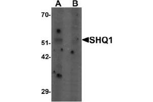 Western blot analysis of SHQ1 in human heart tissue lysate with SHQ1 Antibody  at 1 ug/mL in (A) the absence and (B) the presence of blocking peptide.