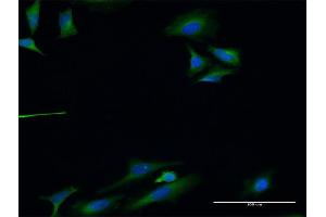 Immunofluorescence of monoclonal antibody to TLN1 on HeLa cell.