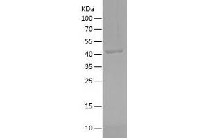 Western Blotting (WB) image for Proteasome (Prosome, Macropain) Subunit, beta Type, 9 (Large Multifunctional Peptidase 2) (PSMB9) (AA 21-219) protein (His-IF2DI Tag) (ABIN7124628)