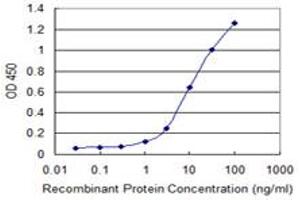 Detection limit for recombinant GST tagged AGTPBP1 is 0.