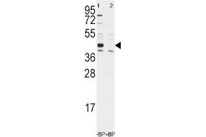 Western Blotting (WB) image for anti-Aldehyde Dehydrogenase 1 Family, Member A3 (ALDH1A3) antibody (ABIN3003524) (ALDH1A3 anticorps)