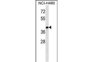 Western blot analysis in NCI-H460 cell line lysates (35ug/lane). (MAGEB10 anticorps  (AA 88-116))