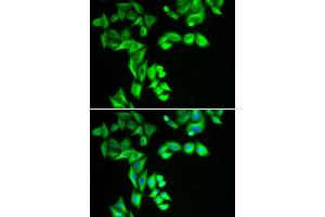 Immunofluorescence analysis of HeLa cells using STRN3 antibody (ABIN6129134, ABIN6148646, ABIN6148648 and ABIN6222490). (STRN3 anticorps  (AA 200-460))