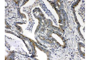 IHC analysis of HSD17B4 using anti- HSD17B4 antibody .