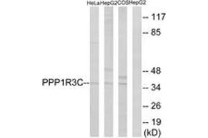 Western Blotting (WB) image for anti-Protein Phosphatase 1, Regulatory Subunit 3C (PPP1R3C) (AA 44-93) antibody (ABIN2890543) (PPP1R3C anticorps  (AA 44-93))