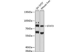 Western blot analysis of extracts of various cell lines, using ST antibody (ABIN6132552, ABIN6148567, ABIN6148570 and ABIN6215114) at 1:1000 dilution.