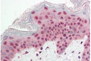 Rabbit Anti-VCP antibody Catalog Number: ARP59365 Formalin Fixed Paraffin Embedded Tissue: Human Adult Skin  Observed Staining: Cytoplasm in hepatocytes Primary Antibody Concentration: 1:600 Secondary Antibody: Donkey anti-Rabbit-Cy3 Secondary Antibody Concentration: 1:200 Magnification: 20X Exposure Time: 0.