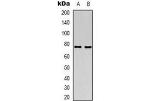 Western blot analysis of ACSS1 expression in HT29 (A), Jurkat (B) whole cell lysates.