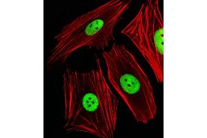 Fluorescent image of SH-SY5Y cells stained with ANP32E Antibody (N-term) (ABIN1944855 and ABIN2838510).