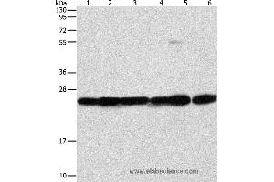 Western blot analysis of Mouse liver and brain tissue, 293T, A549, A431 and PC3 cell, using SIGMAR1 Polyclonal Antibody at dilution of 1:310