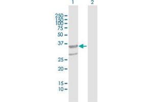 Western Blot analysis of ABHD11 expression in transfected 293T cell line by ABHD11 MaxPab polyclonal antibody. (ABHD11 anticorps  (AA 1-315))