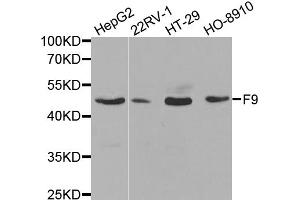 Western blot analysis of extracts of various cell lines, using F9 antibody (ABIN5970759) at 1/1000 dilution. (Coagulation Factor IX anticorps)