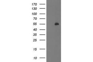 Western Blotting (WB) image for anti-Pre-B-Cell Leukemia Homeobox Protein 1 (PBX1) antibody (ABIN1500045) (PBX1 anticorps)