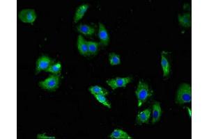 Immunofluorescent analysis of HepG2 cells using ABIN7142627 at dilution of 1:100 and Alexa Fluor 488-congugated AffiniPure Goat Anti-Rabbit IgG(H+L)