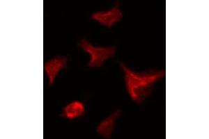 ABIN6266669 staining HeLa by IF/ICC. (UBA7 anticorps  (C-Term))