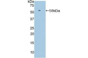 Detection of Recombinant SELL, Human using Polyclonal Antibody to Selectin, Leukocyte (SELL) (L-Selectin anticorps  (AA 109-346))