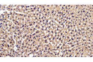 Detection of SQSTM1 in Mouse Liver Tissue using Polyclonal Antibody to Sequestosome 1 (SQSTM1)